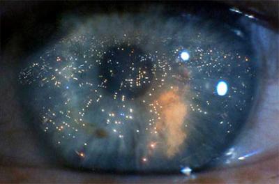 20080804155830-eye-blade-runner.jpg